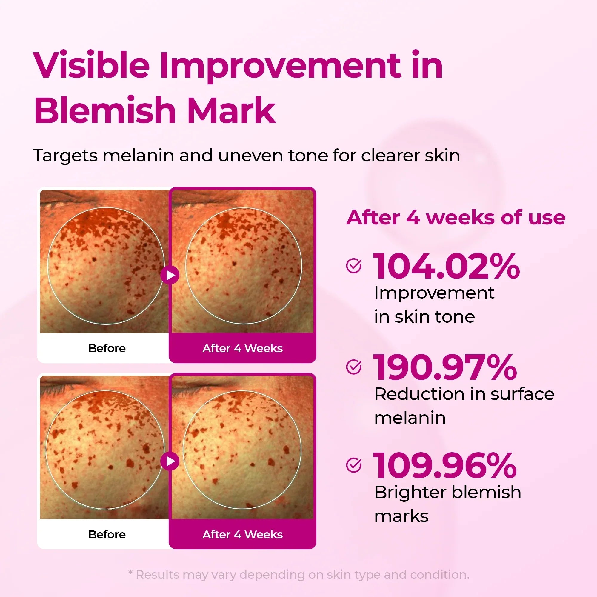 Picotonic Shot Pigmentation Ampoule