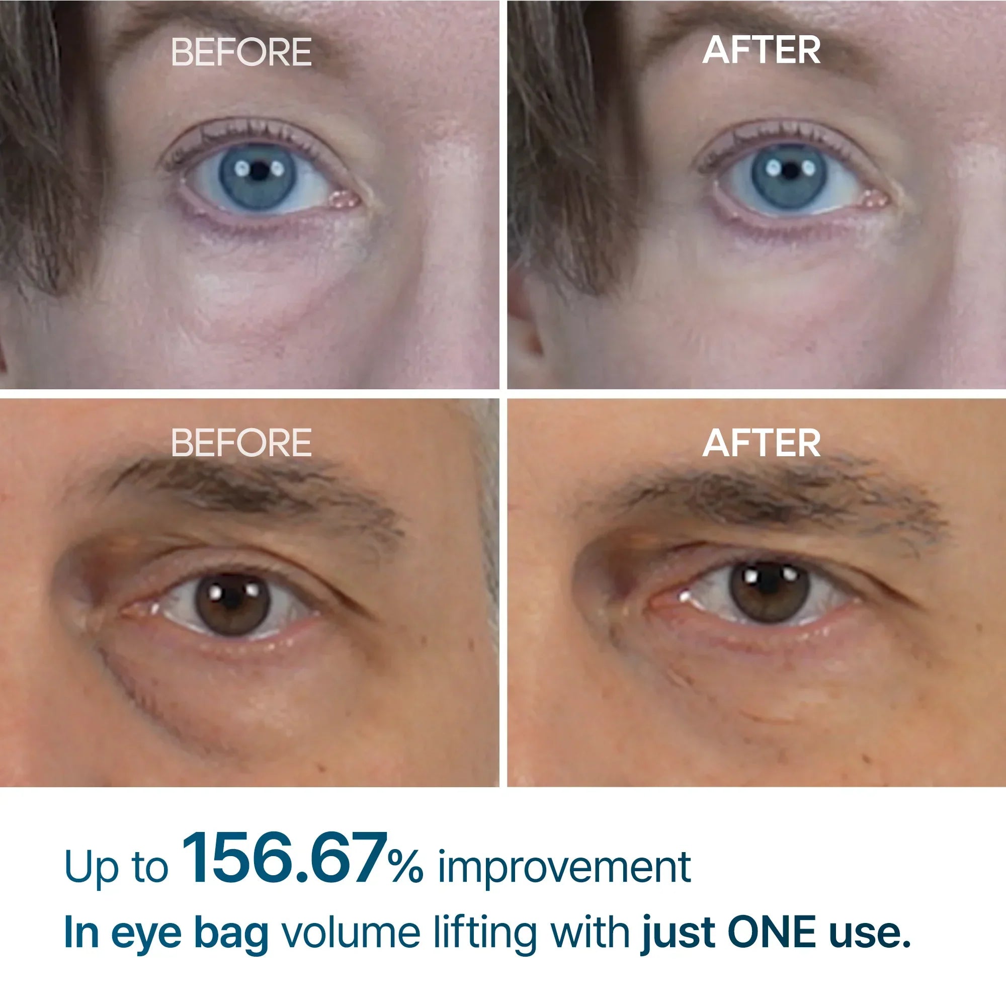 [Day&Night Care] Eyephalt Eyebag Lifting Line